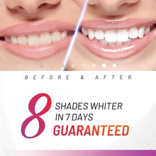 Load image into Gallery viewer, Accelerator Teeth Whitening Kit